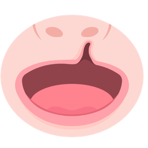 cleft lip & palate management