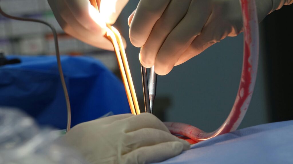 laparoscopy & cystoscopy