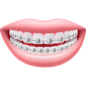 orthodontic treatment